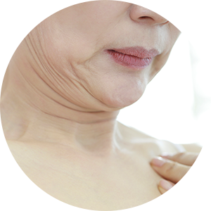 늘어진 피부